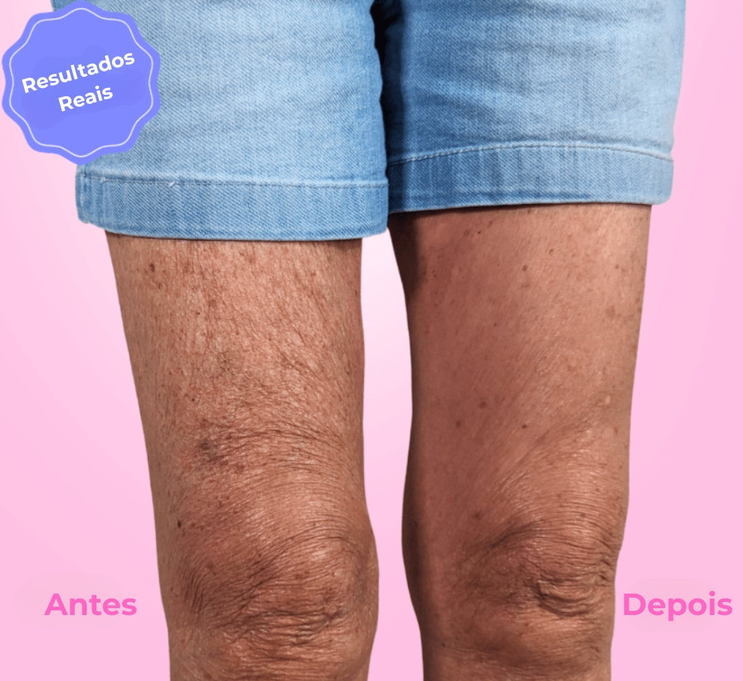 Elev™ Pernas e bumbum