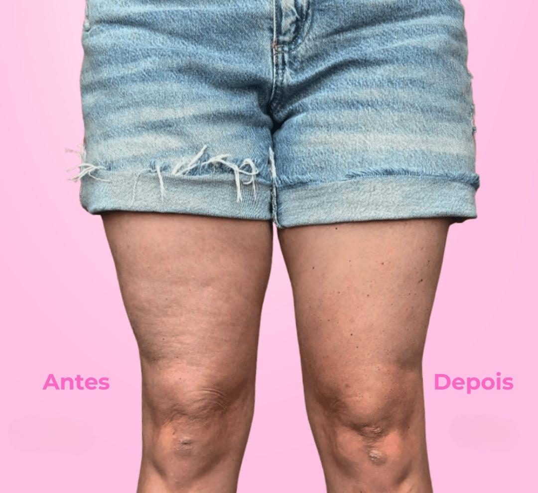 Elev™ Pernas e bumbum